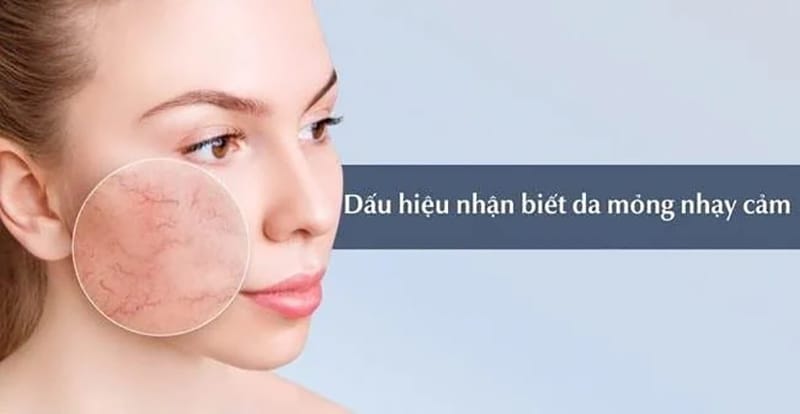 Ửng đỏ, dễ bị trầy, da khô là dấu hiệu phát hiện da mỏng